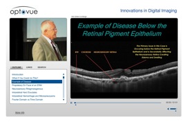 vision expo 2010 oct optical coherence tomography