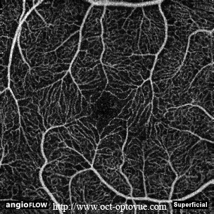 superficial retina angio OCT muratet normal